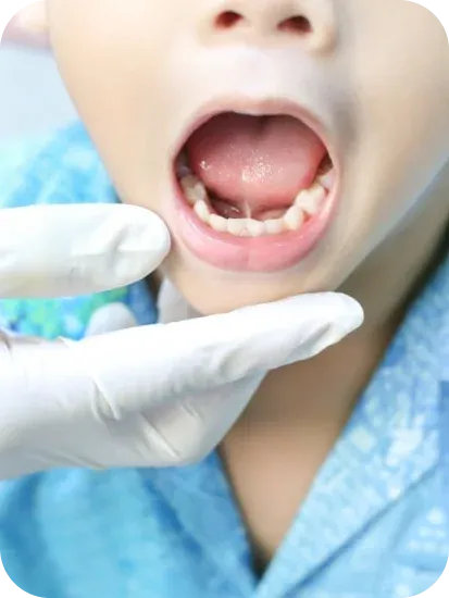 Child Receiving Top Dental Care