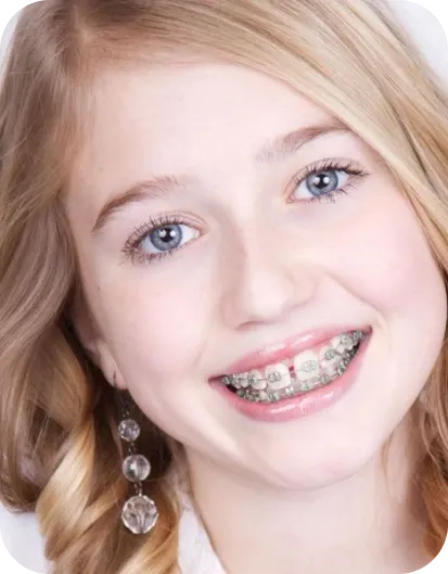 Smiling Child with Braces